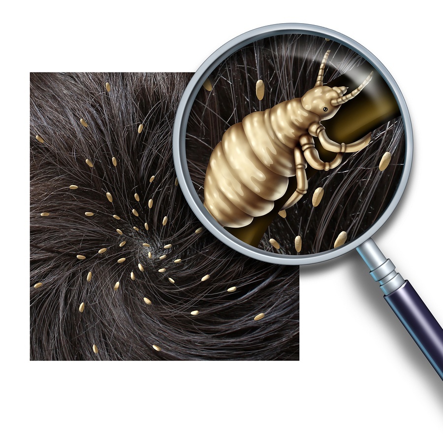 , Part I – Understanding Head Lice, Scabies and Lice Explained