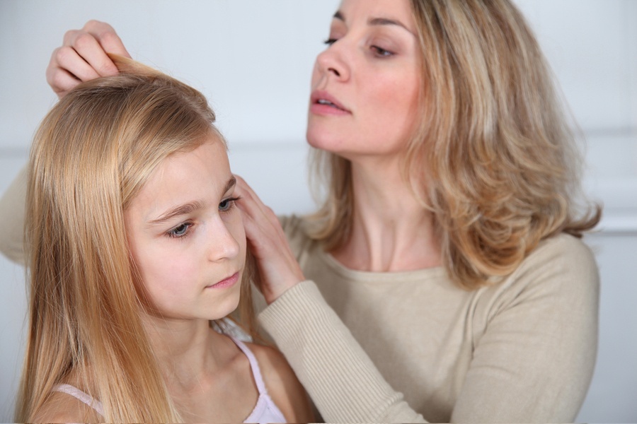 , Part I – Understanding Head Lice, Scabies and Lice Explained